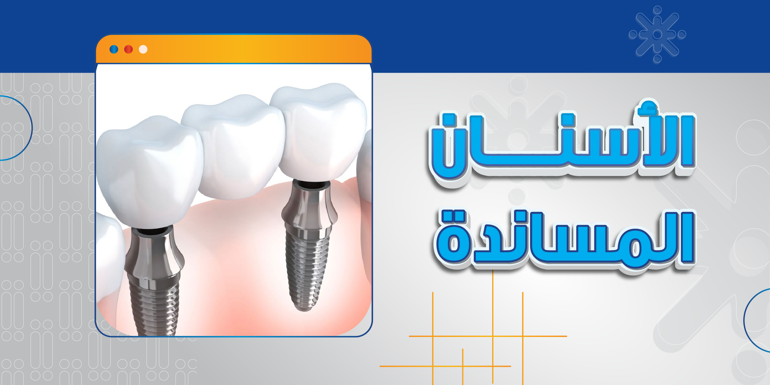 الاسنان المساندة